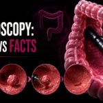 Everything You Need to Know About Colonoscopy