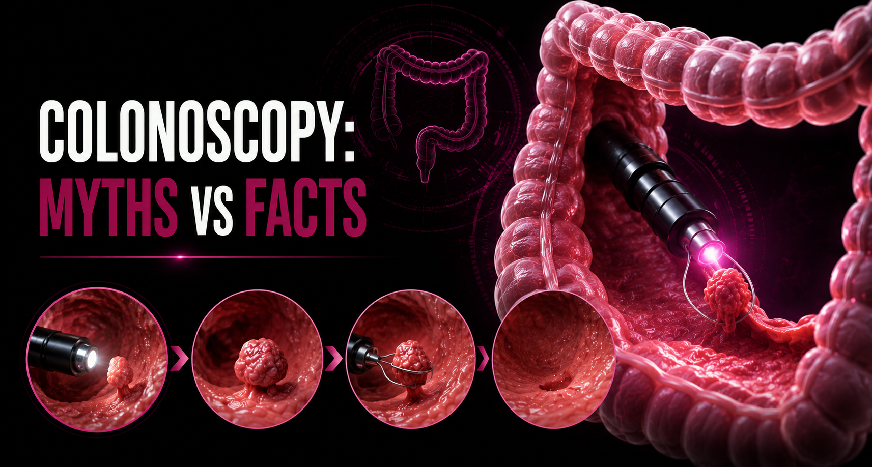 Everything You Need to Know About Colonoscopy
