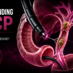 Understanding ERCP